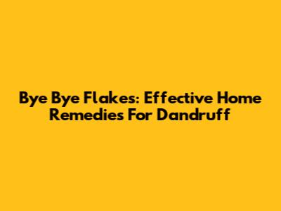 Bye Bye Flakes: Effective Home Remedies For Dandruff