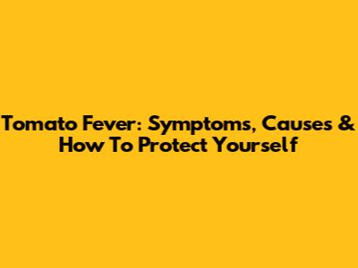 Tomato Fever: Symptoms, Causes & How To Protect Yourself